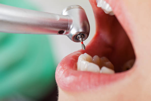 Best Emergency Treatment for Oral Infections in St George, UT
